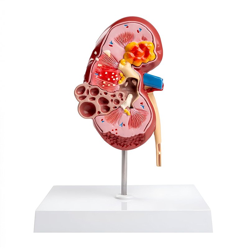 Urinary System Models